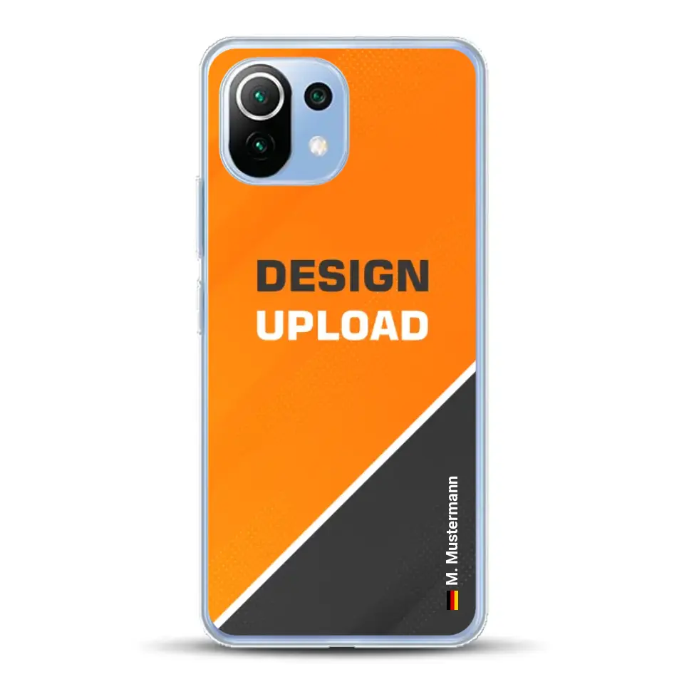 Design Upload - Individuelle Handyhülle für Xiaomi